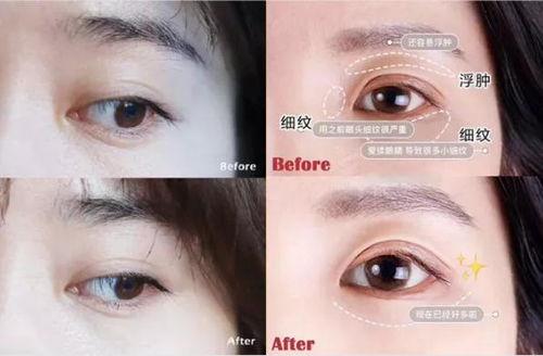 眼霜 娱乐圈,揭秘明星眼霜使用心得